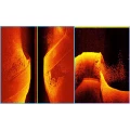 SISTEM GARMIN ULTRA HIGH-DEFINITION SCANNING SONAR SYSTEM